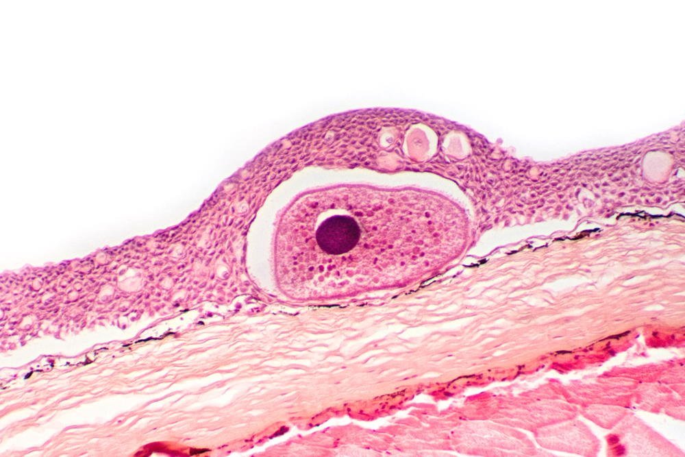 how-to-treat-parasites-in-aquarium-fish-6955268